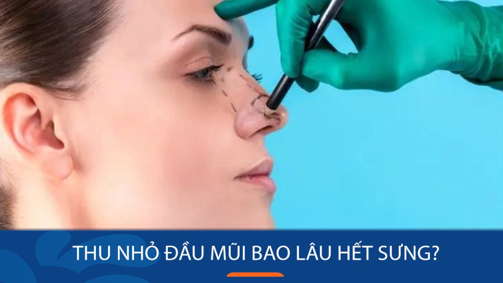 Thu nhỏ đầu mũi bao lâu hết sưng? 3 cách giúp mũi hồi phục nhanh
