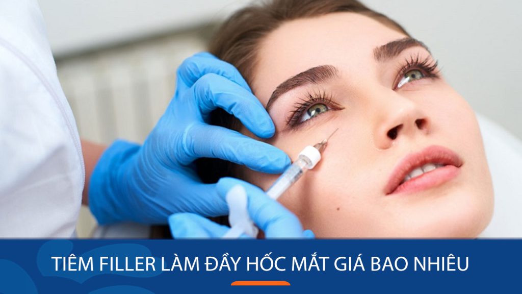 Tiêm filler làm đầy hốc mắt giá bao nhiêu? bảng giá mới