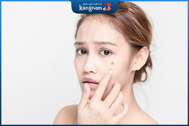 Da mụn không nên bỏ qua bước đắp mặt nạ khi chăm sóc da 