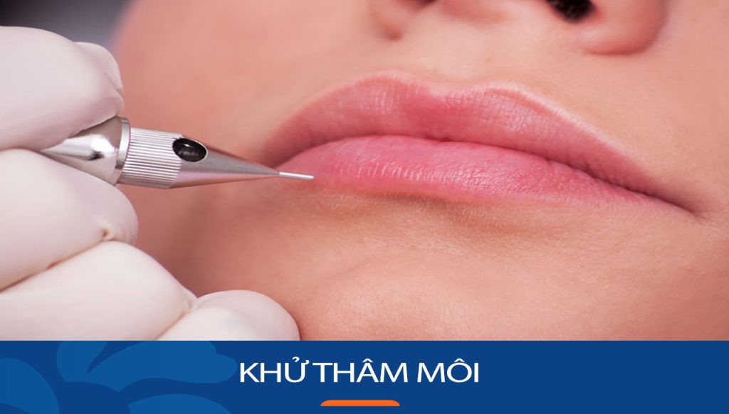 Khử thâm môi là gì? Giải pháp cho đôi môi hồng hào, tươi tắn
