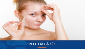 Peel da là gì? Cách chăm sóc sau peel da cho người mới bắt đầu