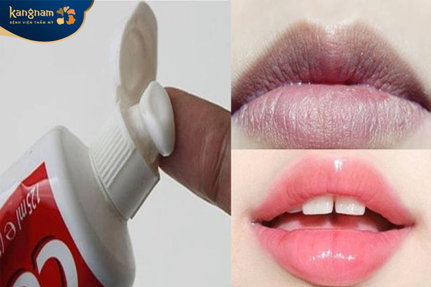 kem đánh răng cũng có thể khử thâm môi