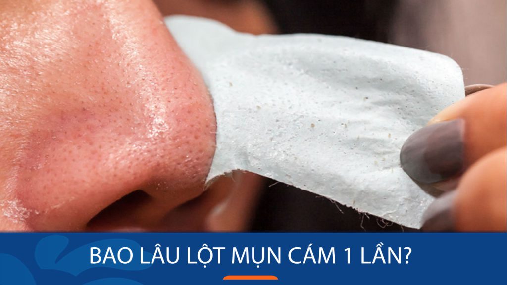 Lột mụn cám bao lâu 1 lần? Bí quyết cho làn da mịn màng