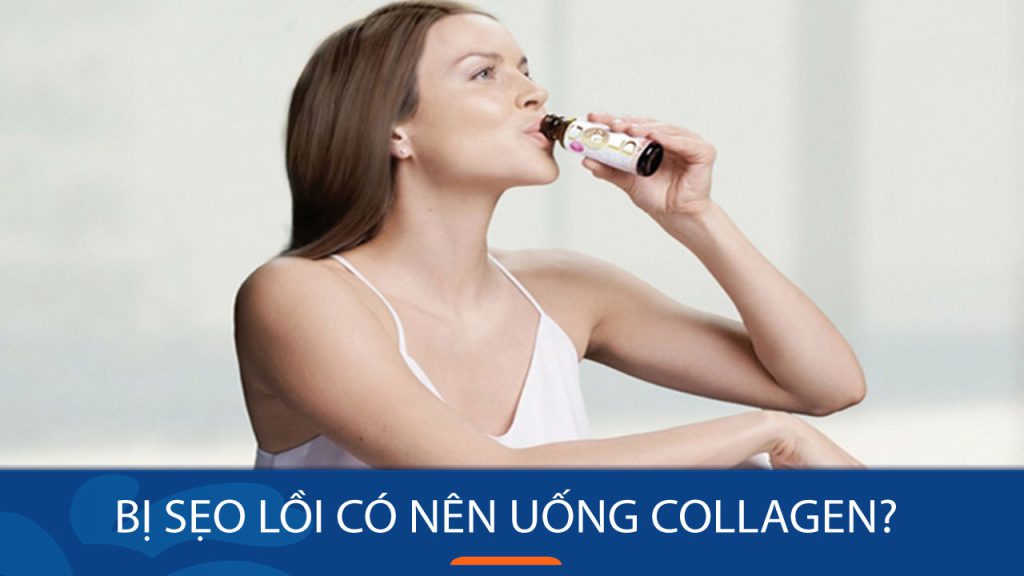 Uống collagen có trị sẹo lồi không? Giải đáp thắc mắc từ chuyên gia!