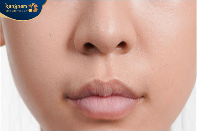 Môi thâm do nguyên nhân chủ quan hoặc khách quan 