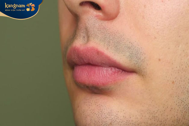 Cẩn thận chăm sóc để màu môi như ý 