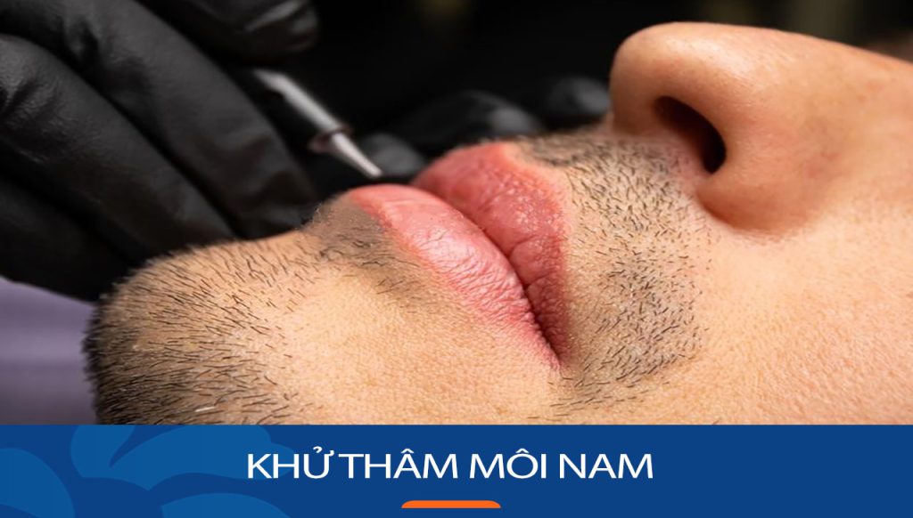 Khử thâm môi nam: Nguyên nhân và phương pháp khắc phục