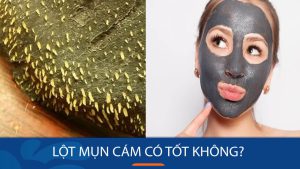 Lột mụn cám có tốt không? Đánh giá hiệu quả lột mụn cám: Trước và sau khi sử dụng