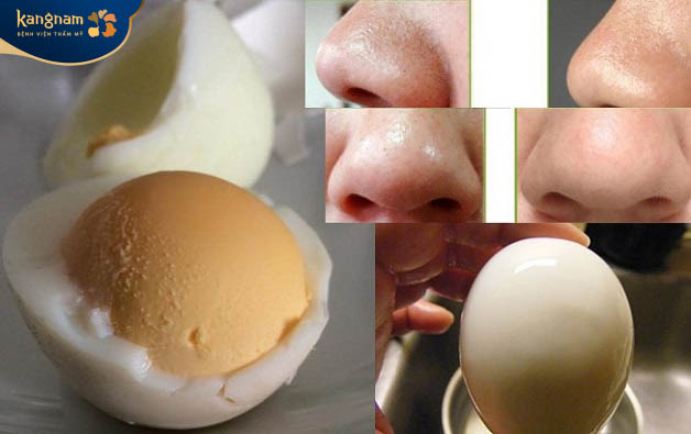 Sử dụng trứng gà điều trị mụn cám và lỗ chân lông to