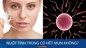 Giải mã bí ẩn: Nuốt tinh trùng có thực sự giúp hết mụn?