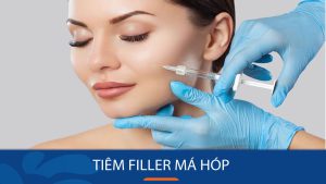 Tiêm filler má hóp – Giải đáp mọi thắc mắc về tiêm filler má hóp