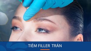 Tiêm filler trán: Bí quyết sở hữu trán đầy đặn, căng mịn chỉ trong tích tắc