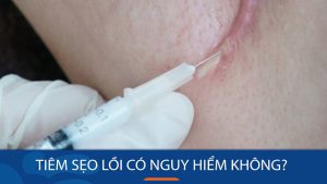 Tiêm Sẹo Lồi Có Nguy Hiểm Không? Lắng Nghe Chuyên Gia Giải Đáp