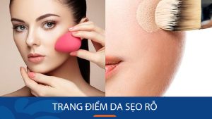 Cách trang điểm da sẹo rỗ ,Bí quyết trang điểm che đi sẹo rỗ hiệu quả