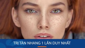 Trị tàn nhang 1 lần duy nhất có hết được không?