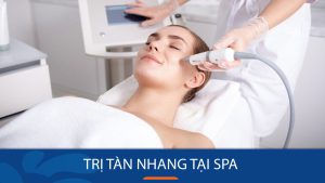 Trị tàn nhang tại spa nên hay không? 3 lý do bạn cần biết