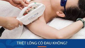 Triệt lông có đau không? Giải đáp mọi thắc mắc từ A đến Z