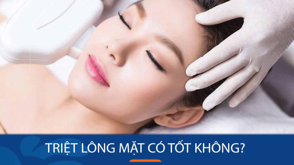 Triệt lông mặt có tốt không? Giải đáp từ chuyên gia da liễu