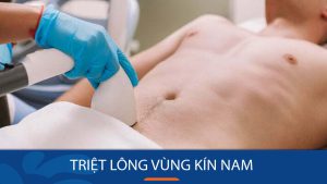 Triệt Lông Vùng Kín Nam: Lựa Chọn Nào Phù Hợp Cho Bạn?