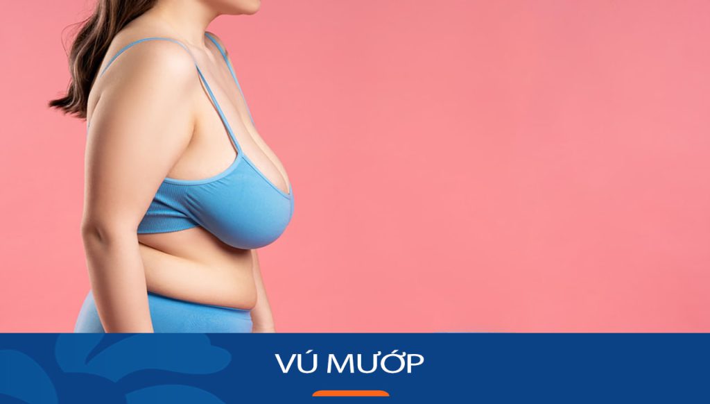 Vú mướp – Vấn đề tế nhị không thể lơ là: Chuyên gia giải đáp mọi thắc mắc về “vú mướp”