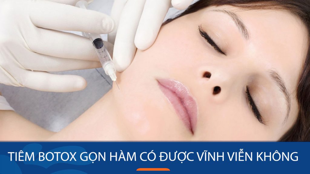 Tiêm botox gọn hàm có vĩnh viễn không? Giải đáp thắc mắc từ chuyên gia