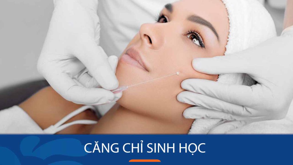 Căng chỉ sinh học: Giải đáp thắc mắc về phương pháp làm đẹp “hot” nhất hiện nay