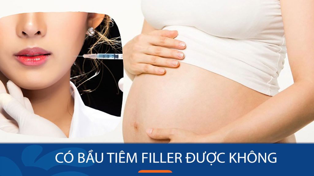 Có bầu tiêm filler được không? Lưu ý quan trọng khi tiêm filler khi mang thai