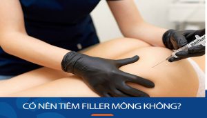 Có nên tiêm filler mông không? Giải mã mọi thắc mắc về tiêm filler mông