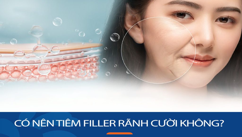 Có nên tiêm filler rãnh cười không? Lợi ích và rủi ro cần biết
