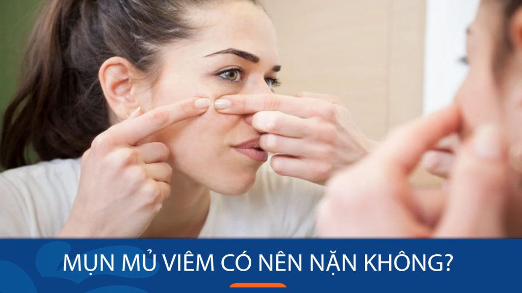Mụn mủ viêm có nên nặn không? Cách nặn mụn mủ viêm đúng chuẩn trong 3 bước đơn giản