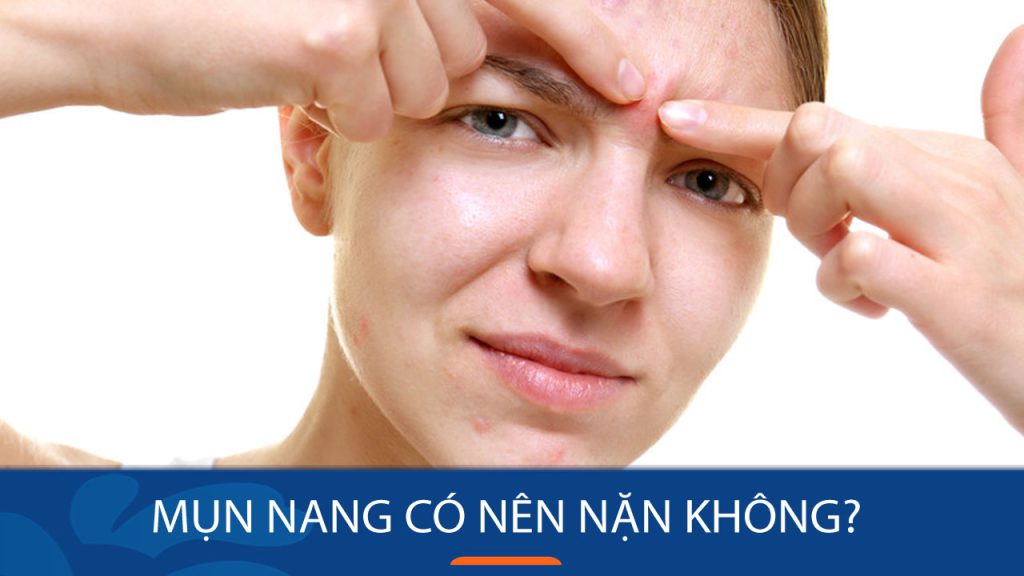 Mụn nang có nên nặn không?  Hậu quả khôn lường nếu nặn sai cách!