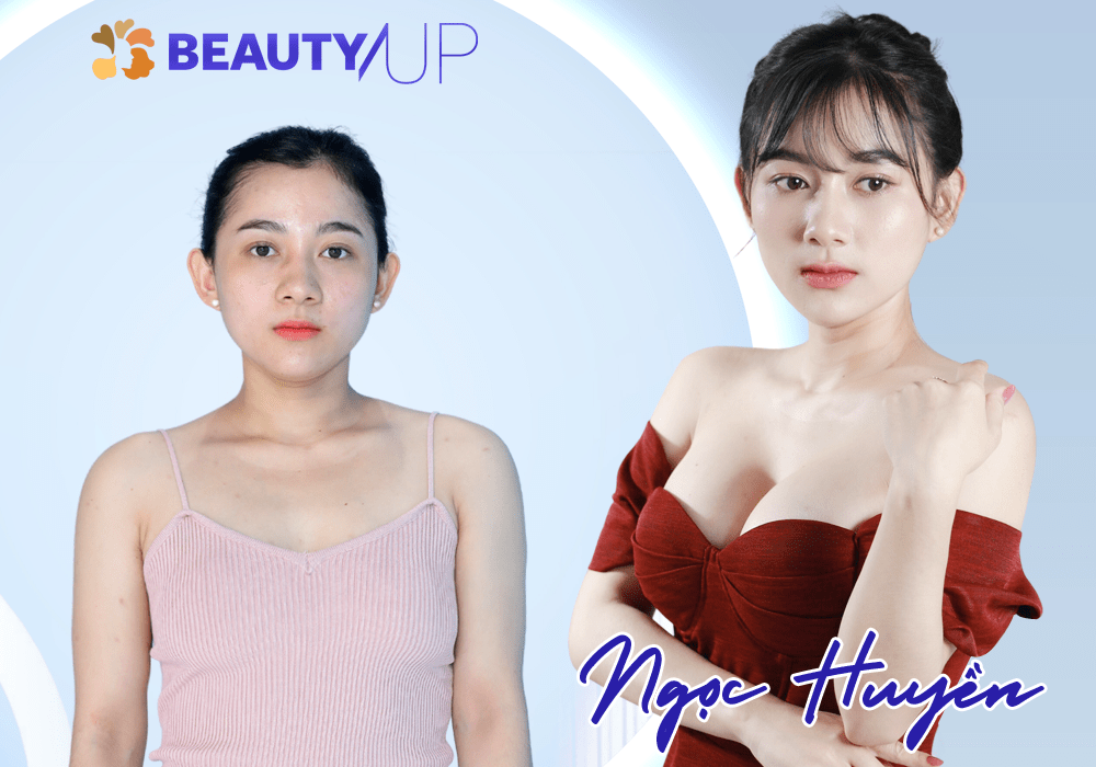 Cô gái Vũng Tàu và hành trình Beauty up cùng Kangnam