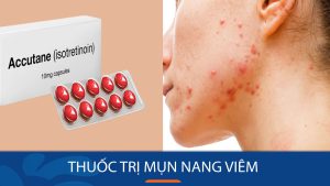 Thuốc trị mụn nang viêm: Top 5 thuốc trị mụn nang viêm được bác sĩ khuyên dùng