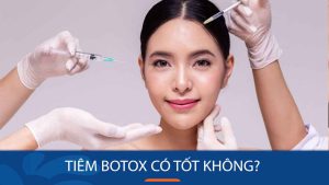 Tiêm botox có tốt không? Bí quyết tiêm botox hiệu quả và an toàn