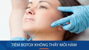 Tiêm botox không thấy mỏi hàm liệu có bình thường? BV Kangnam