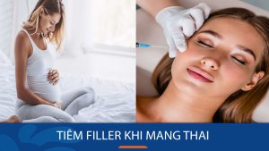 Tiêm filler khi mang thai: An toàn hay nguy hiểm?