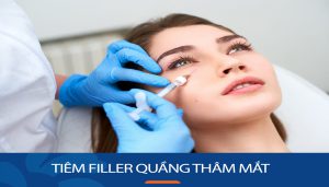 Tiêm filler quầng thâm mắt: Giải pháp hoàn hảo cho đôi mắt sáng rỡ