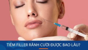 Tiêm filler rãnh cười được bao lâu? Bí quyết duy trì hiệu quả lâu dài