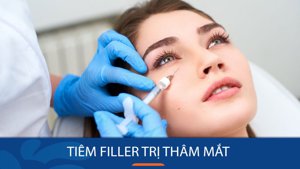 Tiêm filler trị thâm mắt: Giải pháp hoàn hảo cho đôi mắt sáng