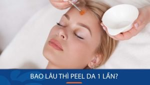 Bao lâu thì peel da 1 lần? giúp cải thiện làn da