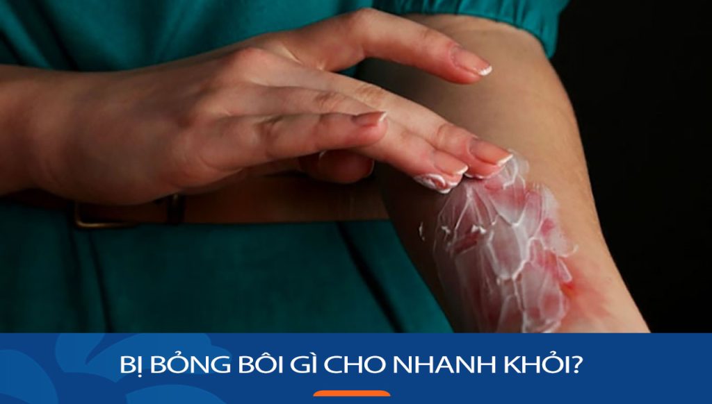 Bị bỏng bôi gì cho nhanh khỏi? Hết đau rát: Phòng tránh để lại sẹo xấu