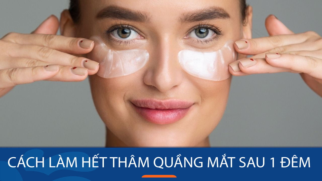 6 Cách làm hết thâm quầng mắt sau 1 đêm hiệu quả