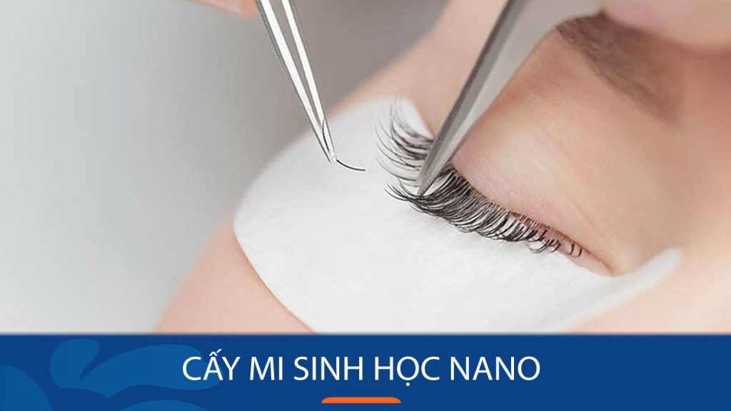Cấy mi sinh học Nano: Tìm hiểu phương pháp cấy mi thế hệ mới