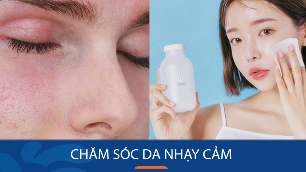Chăm sóc da nhạy cảm đúng cách, tránh gây kích ứng da