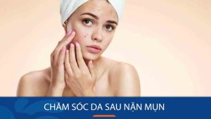 Chăm sóc da sau nặn mụn: 6 quy tắc ‘vàng’ làm dịu da, mờ thâm