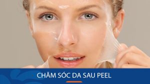 Hướng dẫn cách chăm sóc da sau peel đúng cách ở từng thời điểm