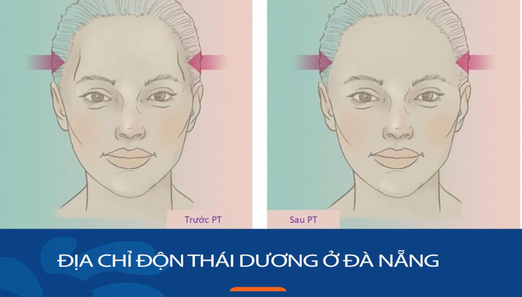 Địa chỉ độn thái dương ở Đà Nẵng, cơ sở vật chất cao cấp