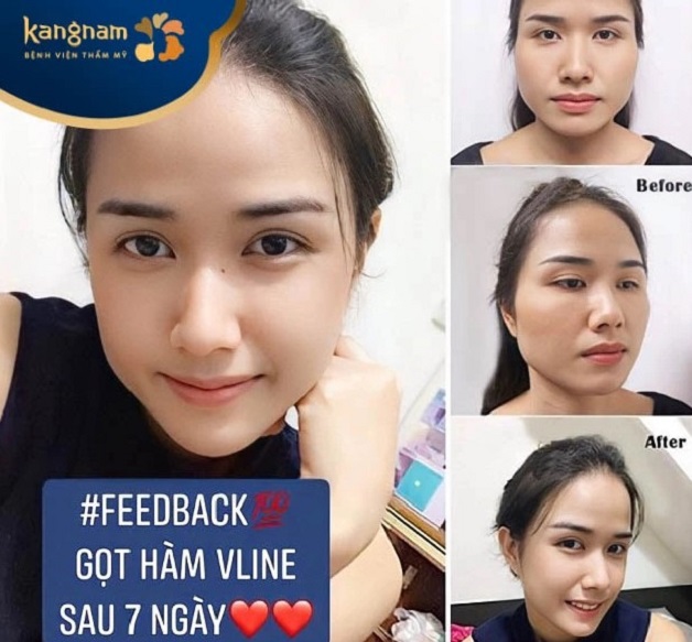 Bạn Thùy Dương gửi feedback