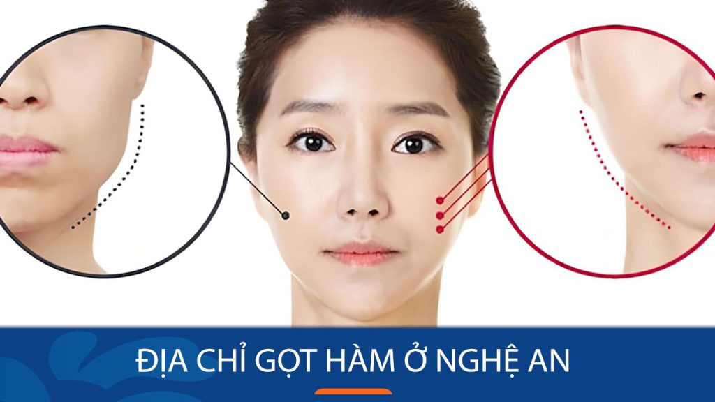 Địa chỉ gọt hàm ở Nghệ An an toàn, chất lượng