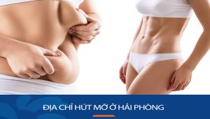 Địa chỉ Hút mỡ ở Hải Phòng an toàn, uy tín nhất, hiệu quả